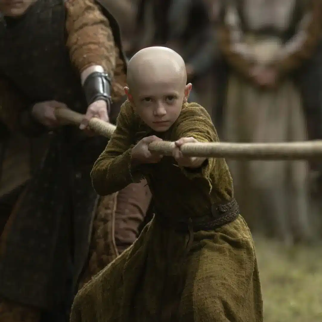 Egg's bald head on display in A Knight of the Seven Kingdoms, the Targaryen trait he conceals under his travel hood while disguised as a common squire alongside Ser Duncan the Tall